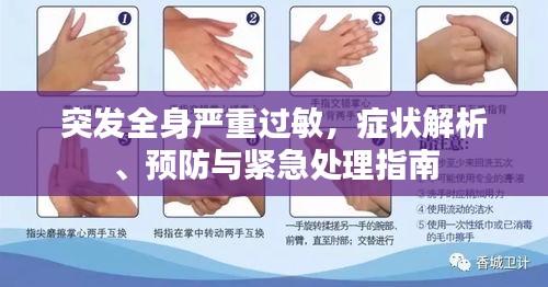 突发全身严重过敏，症状解析、预防与紧急处理指南