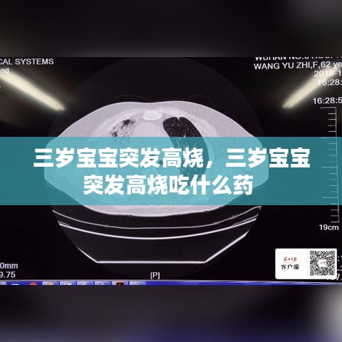 三岁宝宝突发高烧，三岁宝宝突发高烧吃什么药 