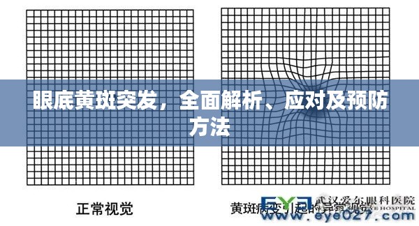 眼底黄斑突发，全面解析、应对及预防方法