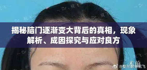 揭秘脑门逐渐变大背后的真相，现象解析、成因探究与应对良方